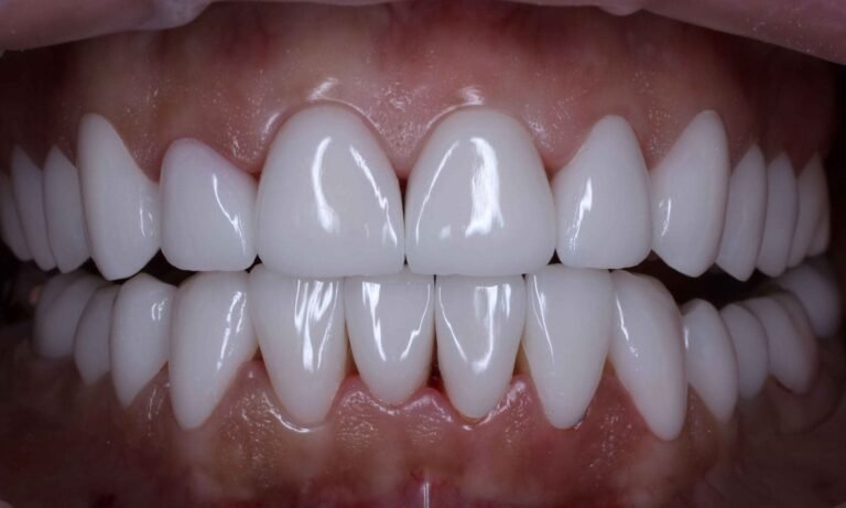 Полезен преглед за Fasety Snap-On Smile Czech